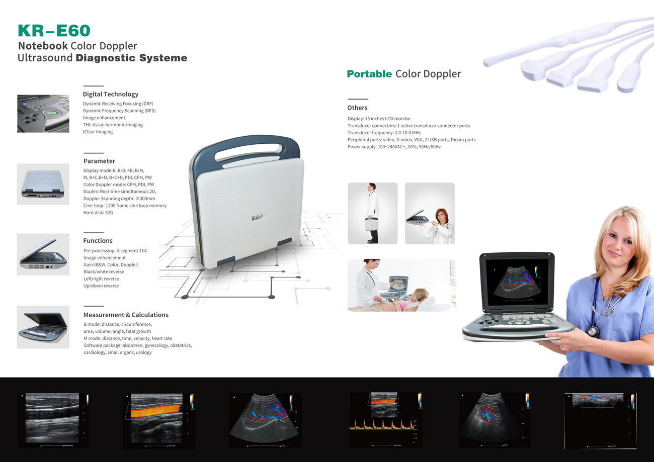 KR-E60筆記本彩超機(jī)